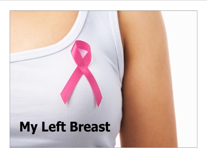 My Left Breast